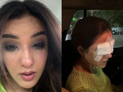 Jasmin Bhasin Reveals Lens Mishap Damaged Her Corneas, Says 'I am in a Lot of Pain'