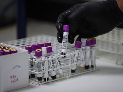 Un estudio abre la puerta a generar células madre en laboratorio para tratar la leucemia