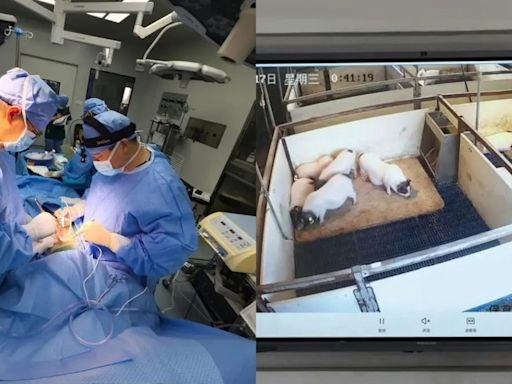 全球首宗！安徽醫院成功移植豬肝給肝癌患者 術後7天一切正常