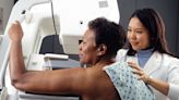 Experts recommend regular mammograms beginning at age 40