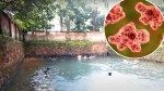 Brain-eating amoeba kills teen after he went swimming in contaminated water — third death in 2 months