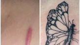 People are getting tattoos to hide scars from surgeries and self-harm. A tattoo artist says they change her clients' lives.