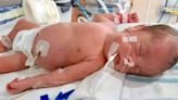Bebés prematuros llenan UCIN Neonatal