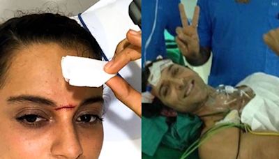 From Hrithik Roshan's Brain Clot to Kangana Ranaut's Forehead Cut: Actors Injured on Set | Throwback - News18
