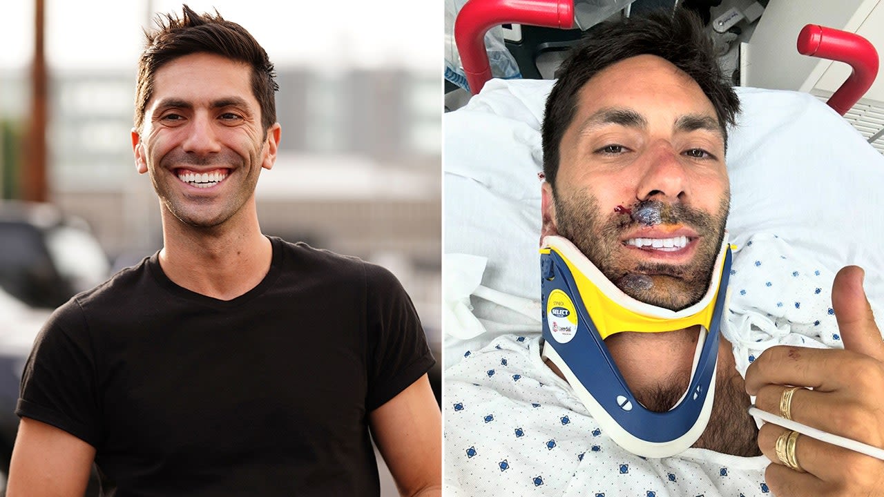 ‘Catfish’ host Nev Schulman ‘lucky to be here,’ revealing he broke his neck in bike accident