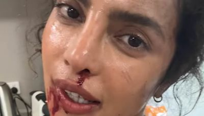 Priyanka Chopra is bruised and bloody for Russo brothers' The Bluff