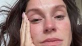 Vicky Pattison seen in tears as she admits to 'not being in control' amid condition 'dismissed' for years