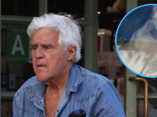 Jay Leno's Wife Spotted With Apparent Black Eye Amid Dementia Battle