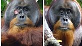 A wild orangutan used a medicinal plant to treat a wound, scientists say