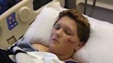 North Carolina boy, 12, attacked by pack of dogs: ‘They were eating him’