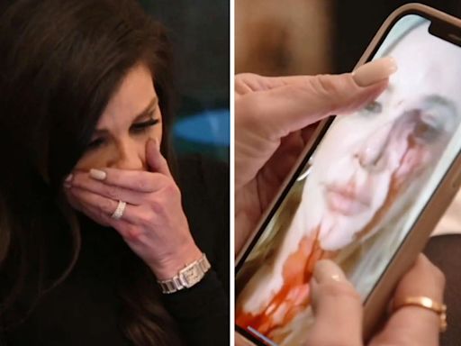 'RHOC': Shannon Beador shocks Heather Dubrow With harrowing photo of her bloodied face post-DUI