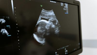 De onde vem o prazo de 22 semanas do PL do Aborto