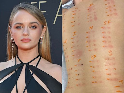 Joey King Shares Results of Allergy Test — and She's Pretty Much Allergic to Everything