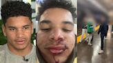 Teen says he was attacked by group inside MBTA station after Red Sox game