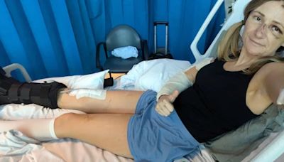 Traveller's hefty bill after moped mishap snapped leg in three places