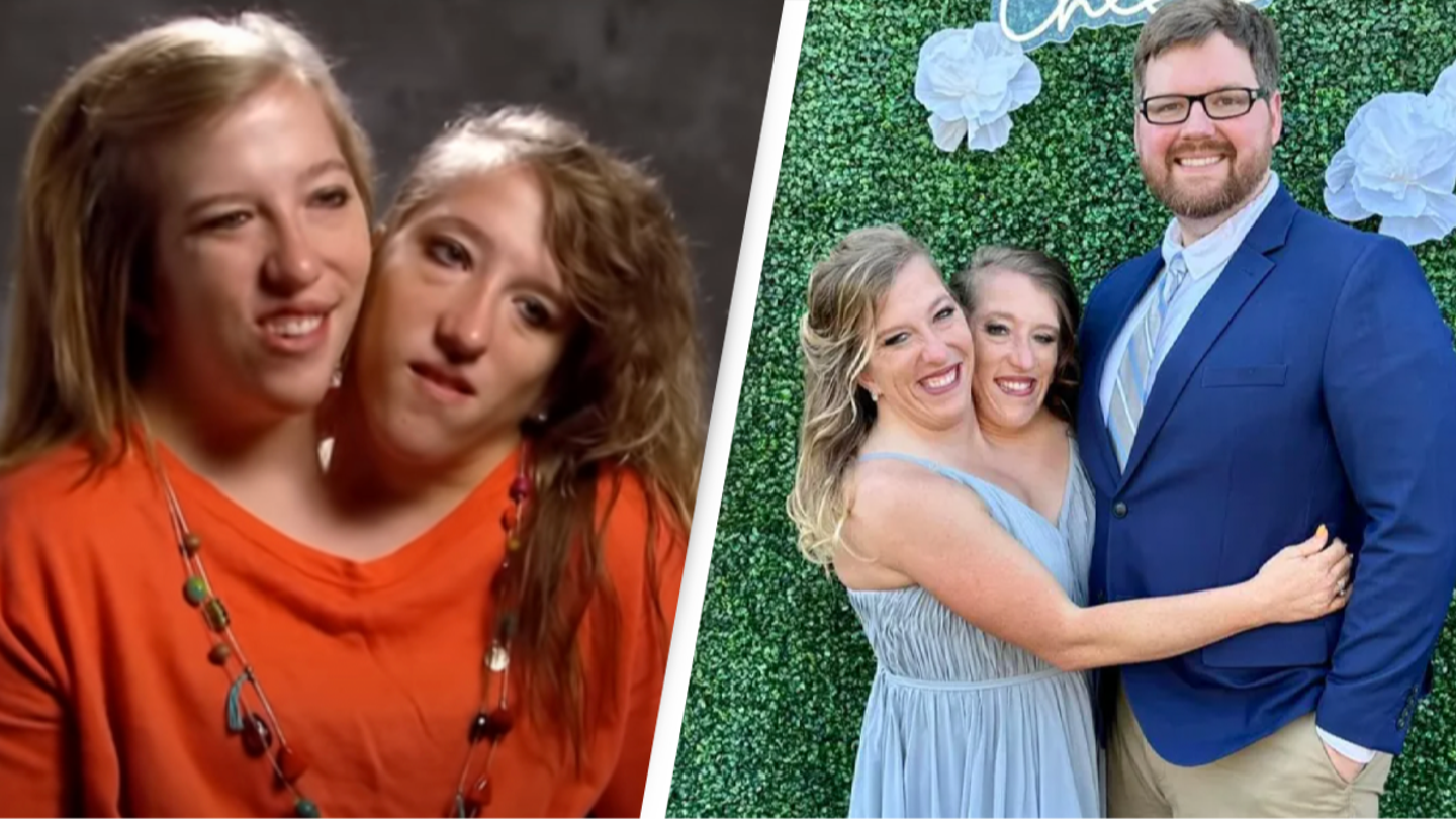 Conjoined twins Abby and Brittany Hensel answer all the questions everyone regularly asks them