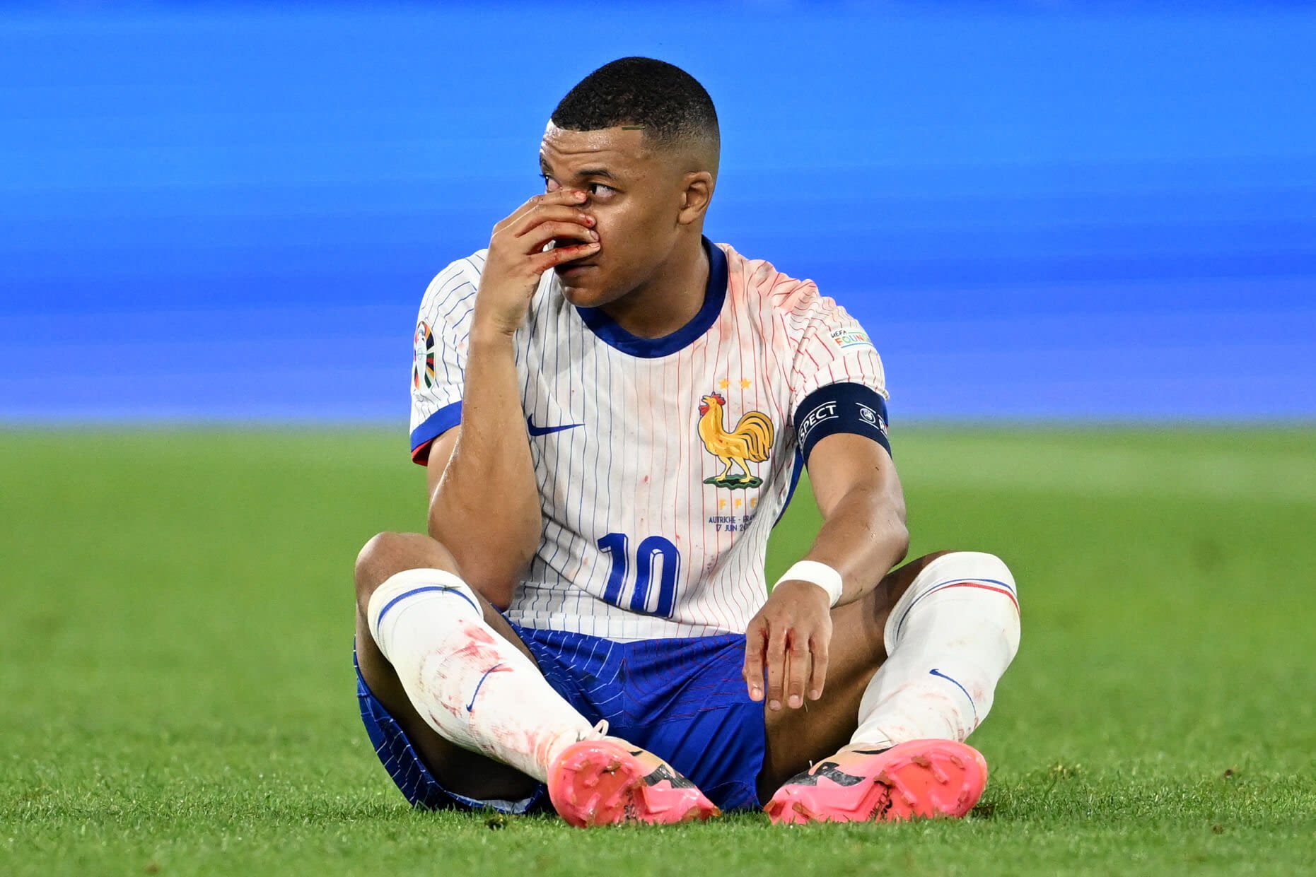 Mbappe fractures nose, will wear mask at Euros