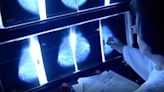National health panel recommends mammograms start at 40