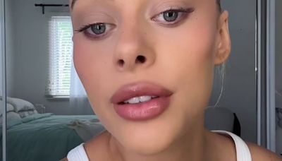 Influencer reveals her genius beauty hack while banned from lip filler