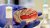 Search for mystery 'nationally distributed food item' that spread E.coli to 113