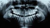 Humans Have A Third Set of Teeth—And New Medicine May Help Them Grow