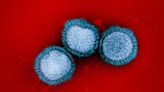 Birth year impacts long-term protection from influenza B