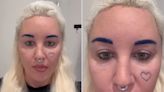 Amanda Bynes' Bleph Surgery 'Looks Natural', Says a Plastic Surgeon — Here's What to Know About the Procedure