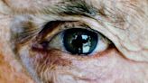 Can glaucoma be fatal? Prognosis, blindness risk, and treatment