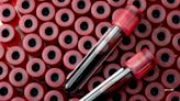 Adalimumab Improves Blood Parameters in Patients With HS