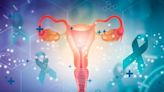 AI may help detect signs of ovarian cancer in the blood