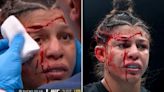 HORROR cut stops UFC 303 fight as elbow leaves star with gash 'down to the BONE'