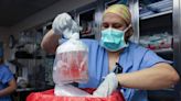 World first as genetically modified pig kidney transplanted into living human