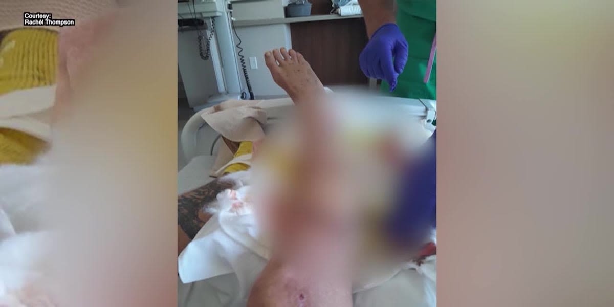 Woman attacked by alligator, 'I just screamed and I pried as hard as I could'