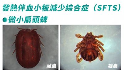 健康網》日本首例蜱蟲病人傳人 疾管署2圖解析症狀、預防 - 自由健康網