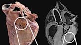 Incredible video takes a trip inside the human heart