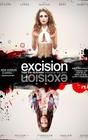 Excision