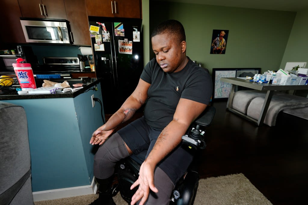 Denver police recruit who lost both legs after ‘Fight Day’ training sues