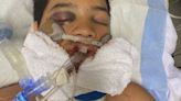 El joven inmigrante venezolano que sobrevivió a un terrible accidente de moto gracias a la perseverancia de su madre