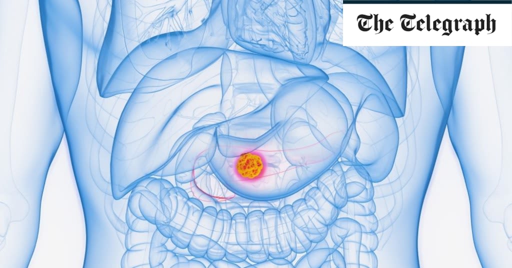 Pancreatic cancer breakthrough as scientists spot gene that allows disease to spread