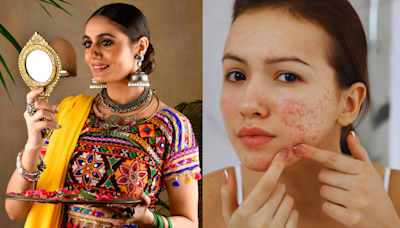 Expert-Backed Tips To Avoid Acne On Sensitive Skin Amidst Navratri Makeup