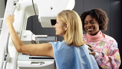 Q&A: Do you know your risks for breast cancer?