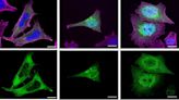 Cellular study of Schaaf-Yang syndrome offers better understanding of a rare disease that causes intellectual disability