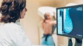 Cáncer de mama: Por qué es importante la mamografía anual a partir de los 40 - Diario Río Negro