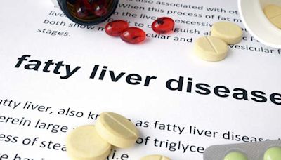 1 In 3 Indians Suffer From Fatty liver, Predates Diabetes: Union Minister