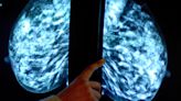 Report suggests people with breast cancer are being ‘systematically left behind’