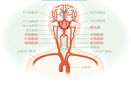 吸菸和三高是危險因子！健檢發現頸動脈狹窄怎麼辦？是不是很嚴重？會不會中風呢？