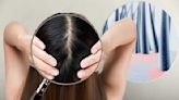 The famous dermatologist says it clearly: This product can harm the scalp