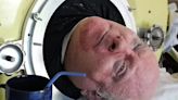 Paul Alexander: ‘Man in the iron lung’ dies after living in tank for 70 years