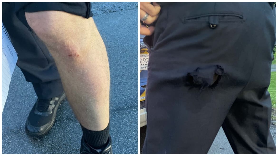 Get a Load of the Cop’s ‘Injuries’ Caused by Scottie Scheffler