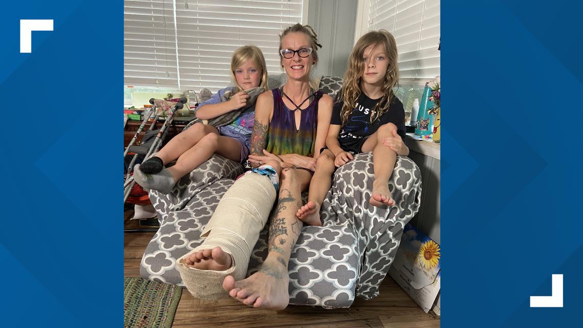 Temple Terrace mother survives alligator bite, says kids helped keep her alive